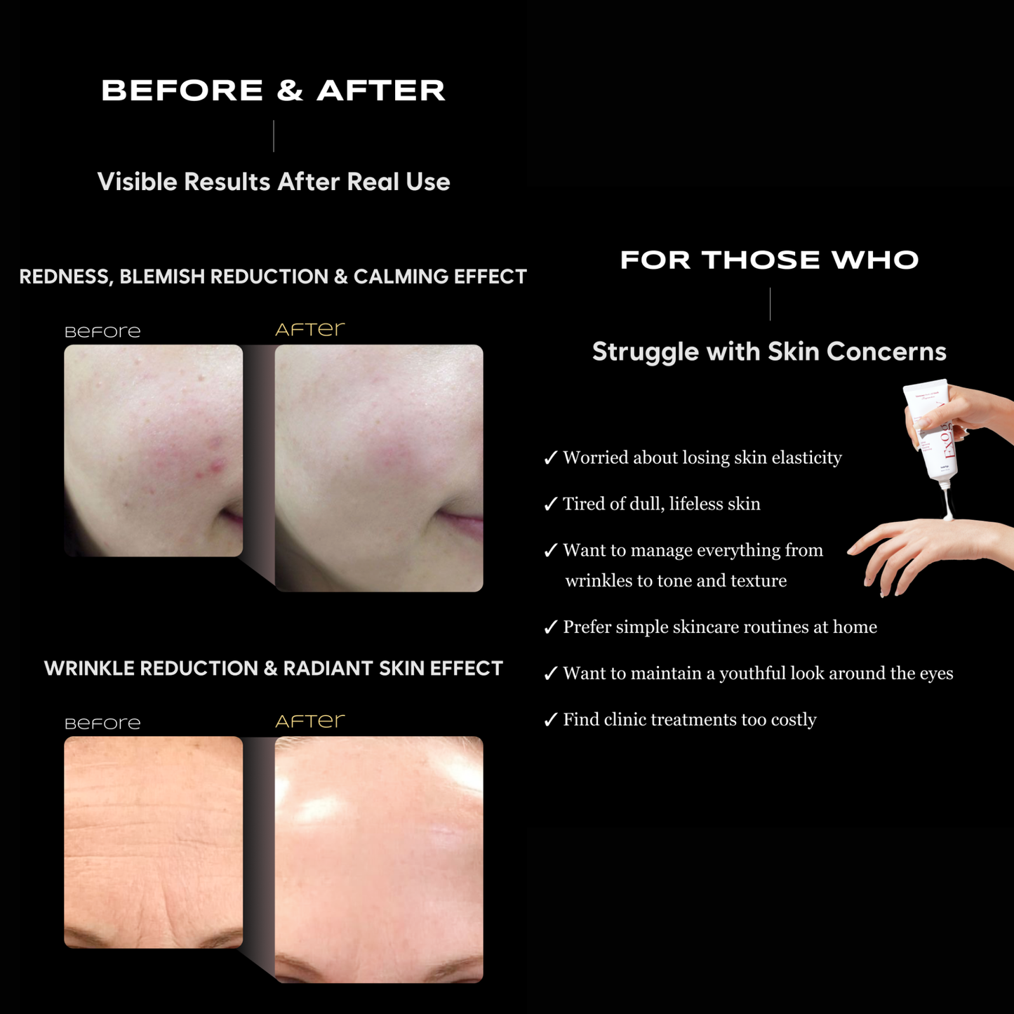 TSJ BIO Exogelly Exosome Peel Off Mask