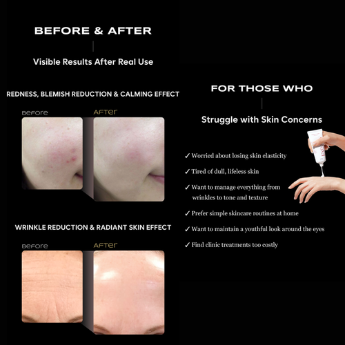 Load image 1 in gallery view. TSJ BIO Exogelly Exosome Peel Off Mask