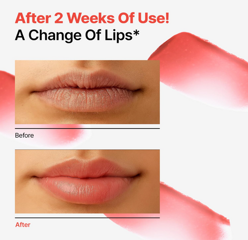 Load image 1 in gallery view. Dr.Different Retinal Lip Balm Tinted